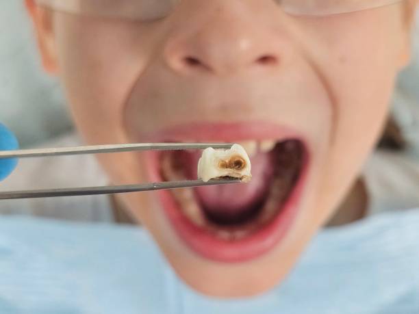 Best Urgent Tooth Repair  in North Bend, NE